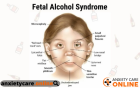 Get To Know About Fetal Alcohol Syndrome In Adults From Anxietycareonline