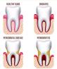 Are you Looking for Periodontal Treatment in Hicksville, Flushing & Floral Park?