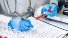 Pathology and laboratory services | blood test laboratory - Mangalam Pathology Laboratory Ahmedabad
