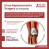 Advanced Knee Replacement Surgery (Arthroplasty) at Metro Hospital, Noida