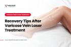 After Varicose Vein Laser Treatment: 7 Tips for a Speedy Recovery