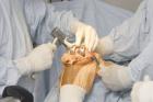 Ortho surgeon in Madurai
