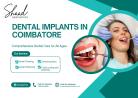 Dental Implants in Coimbatore