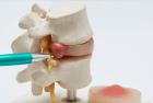 Pain Management Glenn Dale